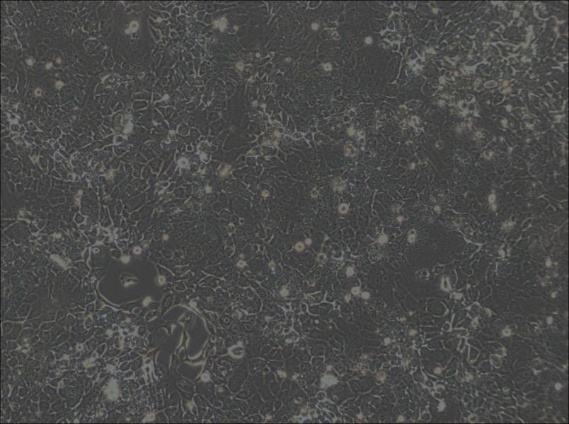 OE33 Cell Complete Medium - 2