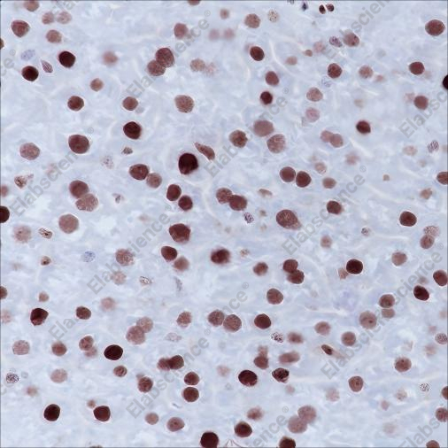 Recombinant MSH6 Monoclonal Antibody - 4