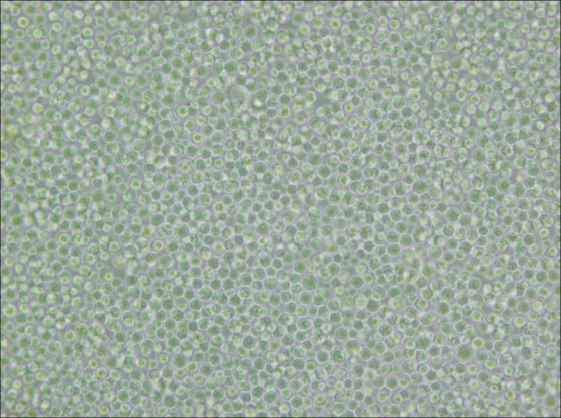 SU-DHL-4 Cell Complete Medium - 6