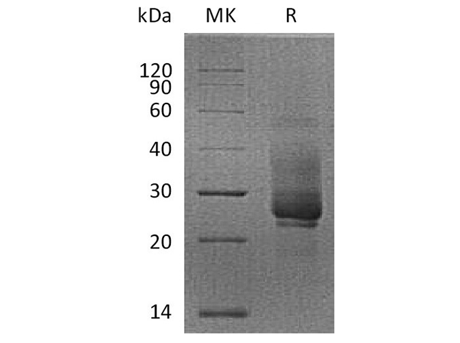 Recombinant Cynomolgus TIM-3/HAVCR2 Protein (His Tag)