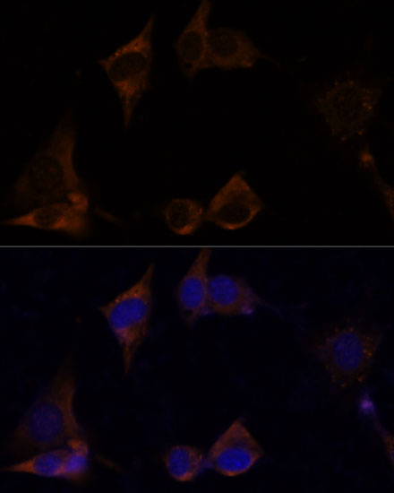 Immunofluorescence analysis of NIH/3T3 cells using IL13RA2 Polyclonal Antibody at dilution of 1:100. Blue: DAPI for nuclear staining.