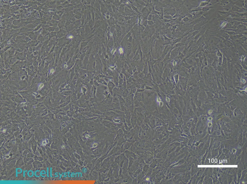 Mouse Retinal Muller Cell Complete Medium - 2