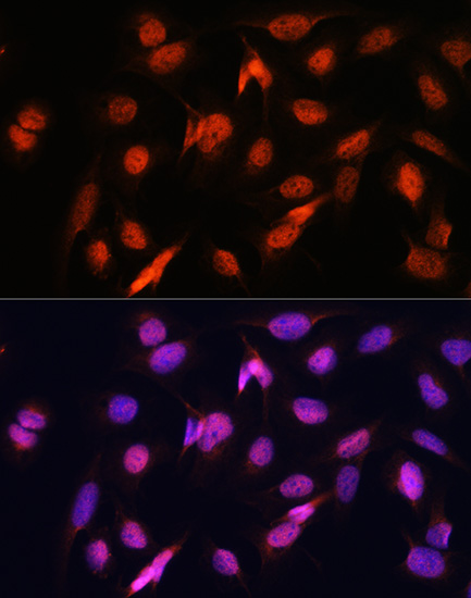 Immunofluorescence analysis of U2OS cells using OTUB1 Polyclonal Antibody at dilution of  1:100. Blue: DAPI for nuclear staining.