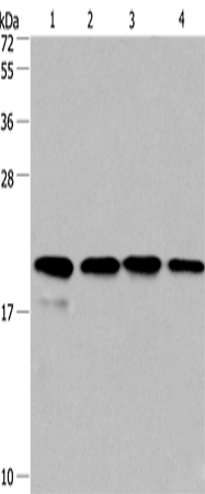 Western Blot analysis of PC3 and 293T cell, Human liver cancer tissue and hela cell using Cyclophilin F Polyclonal Antibody at dilution of 1:500