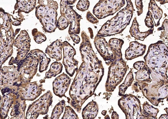 CD113/Nectin-3 Monoclonal Antibody-searchlist-1