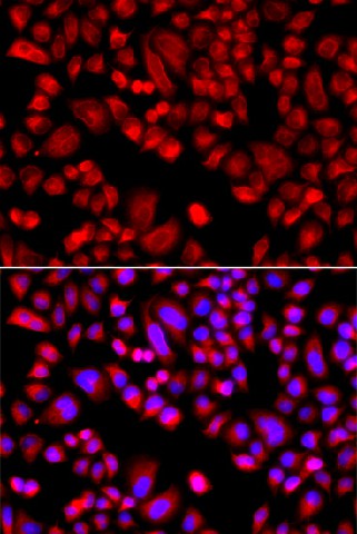 Immunofluorescence analysis of A549 cells using ARPC3 Polyclonal Antibody