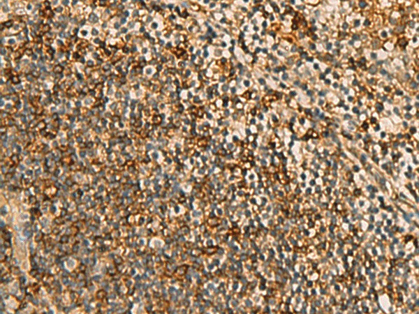 Immunohistochemistry of paraffin-embedded Human tonsil tissue  using HORMAD2 Polyclonal Antibody at dilution of 1:45(?200)