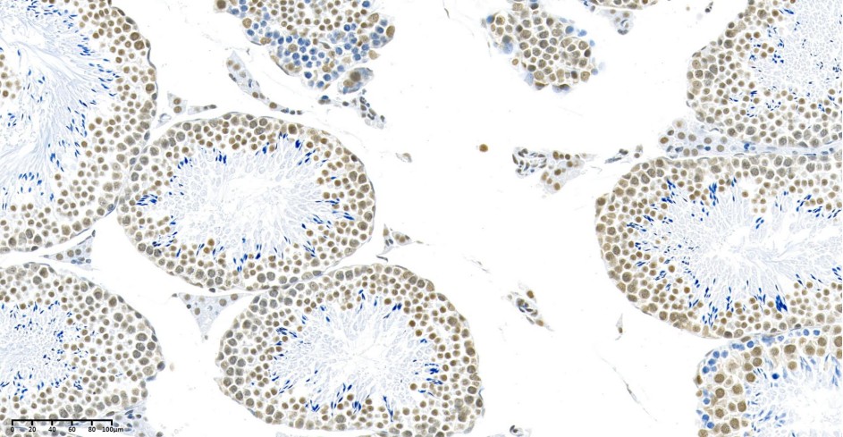 Recombinant DDX5 Monoclonal Antibody - small - 2