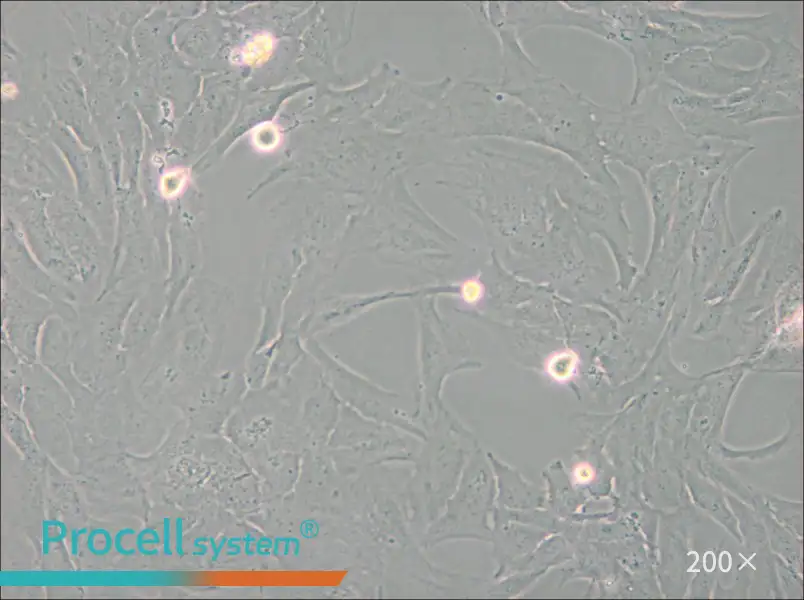 NCI-H196 Cell Complete Medium - 6
