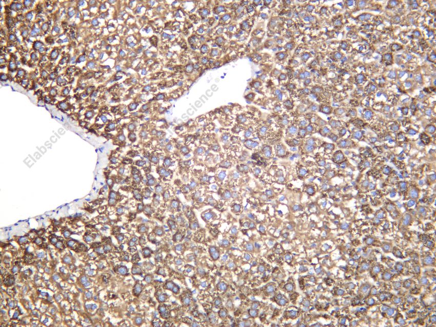 Recombinant MBL2 Monoclonal Antibody - 3
