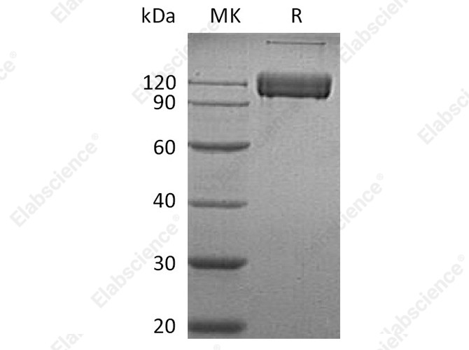 Recombinant Human ALCAM/CD166 Protein (Fc Tag) - 1