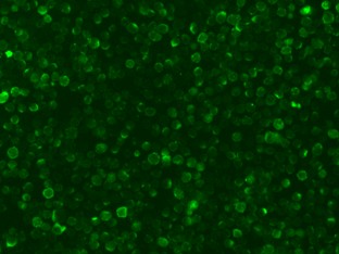 Recombinant TNF-alpha Monoclonal Antibody-searchlist-1