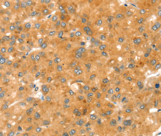 RAB27A Polyclonal Antibody - 2