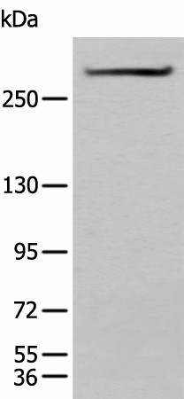 Western blot analysis of Mouse heart tissue lysate  using SPTA1 Polyclonal Antibody at dilution of 1:550