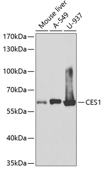 Western blot analysis of extracts of various cell lines using CES1 Polyclonal Antibody at 1:1000 dilution.