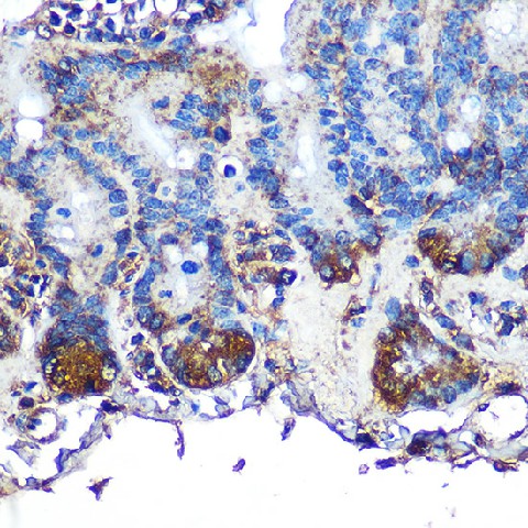 Immunohistochemistry of paraffin-embedded mouse intestin using ITLN1 Polyclonal Antibody at dilution of 1:100 (40x lens).Perform microwave antigen retrieval with 10 mM PBS buffer pH 7.2 before commencing with IHC staining protocol.