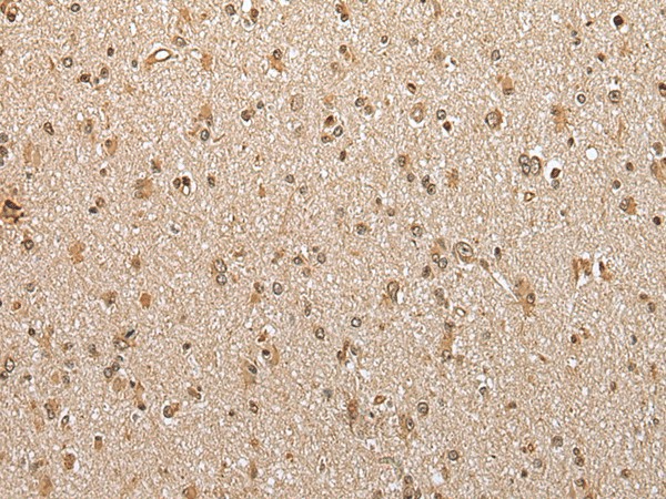 Immunohistochemistry of paraffin-embedded Human brain tissue  using ABHD14B Polyclonal Antibody at dilution of 1:30(?200)