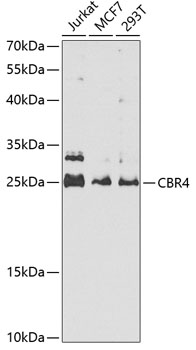 Western blot analysis of extracts of various cell lines using CBR4 Polyclonal Antibody at 1:1000 dilution.