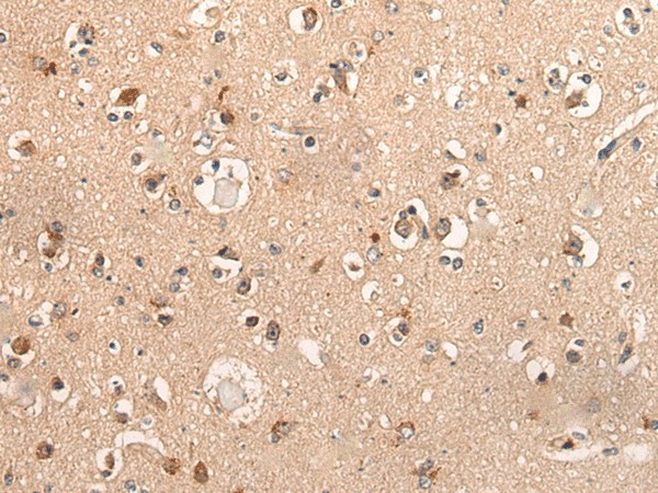 Immunohistochemistry of paraffin-embedded Human brain tissue  using DYNAP Polyclonal Antibody at dilution of 1:50(?200)