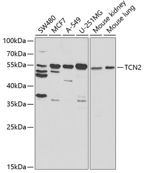 Western blot analysis of extracts of various cell lines using TCN2 Polyclonal Antibody at 1:1000 dilution.