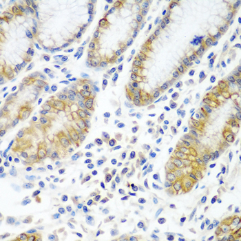 Immunohistochemistry of paraffin-embedded Human stomach using ATAD3A Polyclonal Antibody at dilution of  1:100 (40x lens).