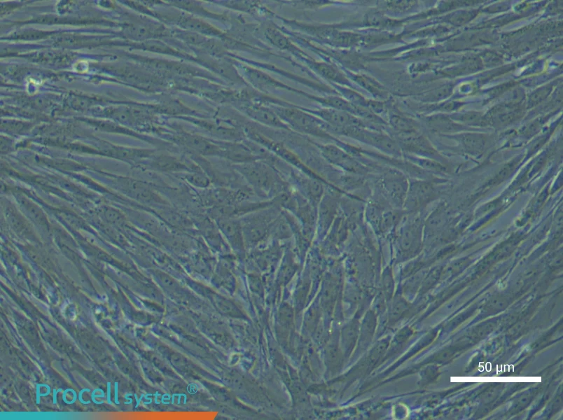 Human Lung Fibroblast Complete Medium - small - 5
