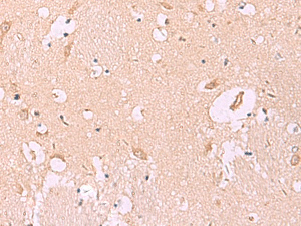 Immunohistochemistry of paraffin-embedded Human brain tissue  using MKS1 Polyclonal Antibody at dilution of 1:50(?200)