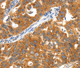 TRAF3 Polyclonal Antibody - 2