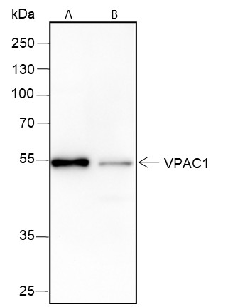 Recombinant VPAC1 Monoclonal Antibody-searchlist-1
