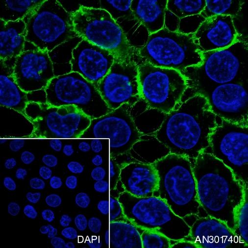 Recombinant Thrombomodulin Monoclonal Antibody - small - 2
