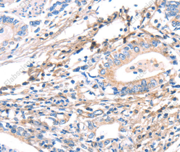 TWF2 Polyclonal Antibody - 2