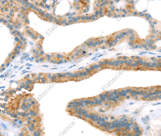 TNIP2 Polyclonal Antibody - 2