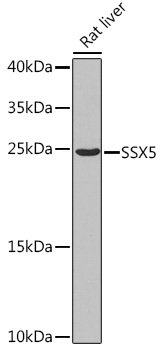 Western blot analysis of extracts of Rat liver using SSX5 Polyclonal Antibody at 1:1000 dilution.