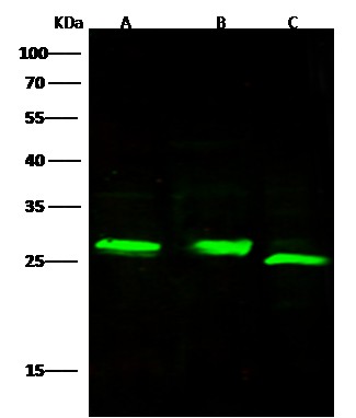 Recombinant Adipsin/Complement Factor D/CFD Monoclonal Antibody-searchlist-1