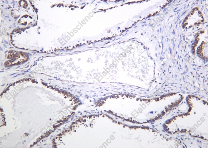 Recombinant DCLK1 Monoclonal Antibody - 1