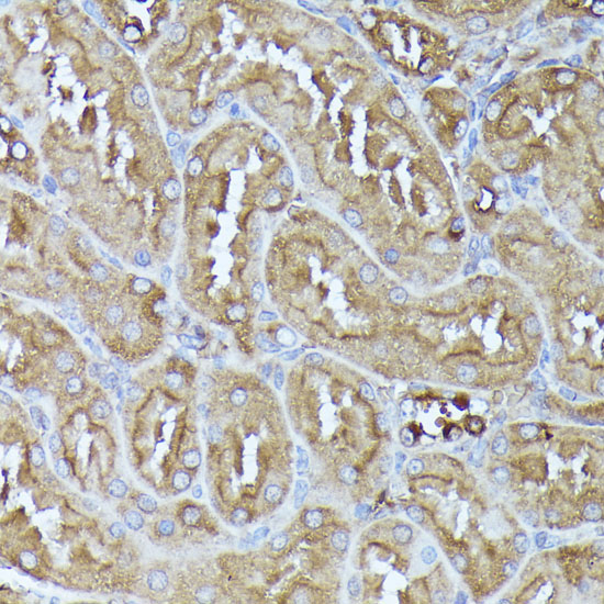 Immunohistochemistry of paraffin-embedded Rat kidney using DLAT Polyclonal Antibody at dilution of  1:100 (40x lens).