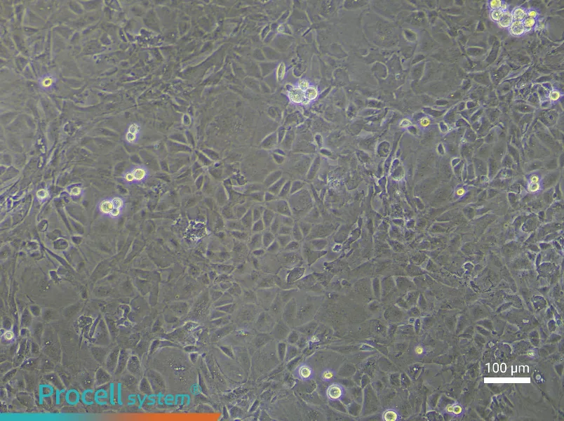 Rat Pulmonary Microvascular Endothelial Cell Complete Medium - 2