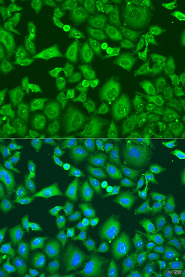 Immunofluorescence analysis of U2OS cells using KIF11 Polyclonal Antibody at dilution of  1:100. Blue: DAPI for nuclear staining.