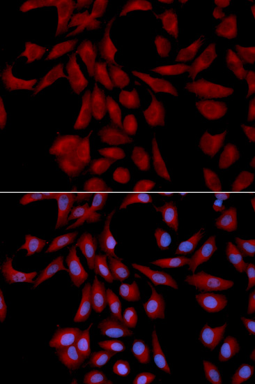 Immunofluorescence analysis of U2OS cells using UBE2I Polyclonal Antibody
