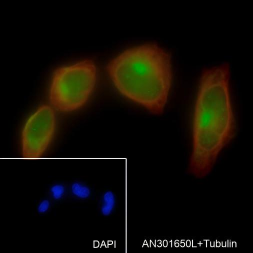 Recombinant S100A13 Monoclonal Antibody - small - 2