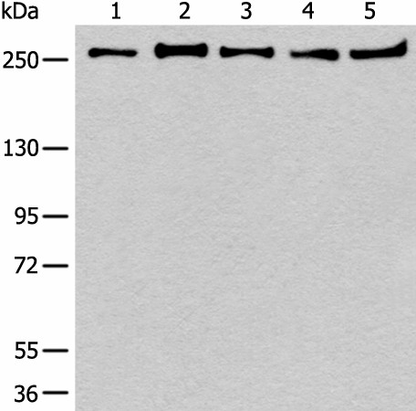 Western blot analysis of 293T K562 Raji Hela and NIH/3T3 cell lysates  using PRPF8 Polyclonal Antibody at dilution of 1:600