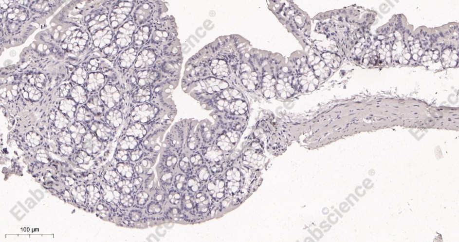 Recombinant Ki67 Monoclonal Antibody - 3