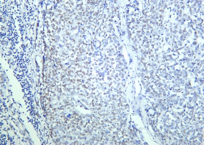 Recombinant BRG1 Monoclonal Antibody - small - 2