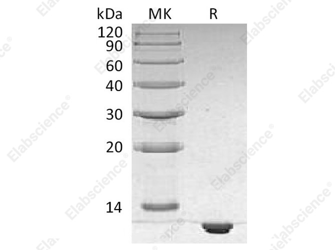 Recombinant Human S100B Protein (His Tag) - 1