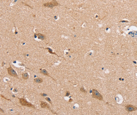 Immunohistochemistry of paraffin-embedded Human brain  using MSMB Polyclonal Antibody at dilution of 1:30