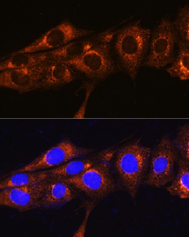 Immunofluorescence analysis of NIH/3T3 cells using FREM2 Polyclonal Antibody at dilution of 1:100. Blue: DAPI for nuclear staining.