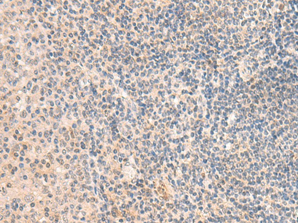 Immunohistochemistry of paraffin-embedded Human tonsil tissue  using GRM2 Polyclonal Antibody at dilution of 1:50(?200)