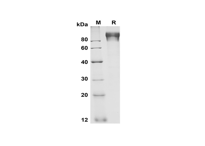 Recombinant Human IL22 Protein(Avi,His Tag)-产品推荐-1