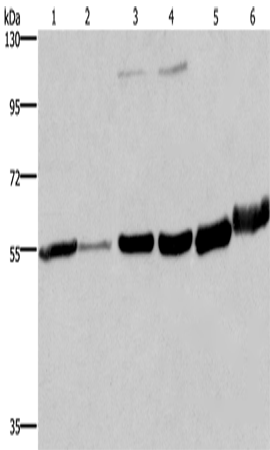 Western Blot analysis of Human fetal liver and testis tissue, 293T and A172 cell, Mouse brain and Human fetal brain tissue using MCHR1 Polyclonal Antibody at dilution of 1:350