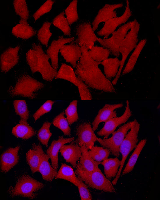 Immunofluorescence analysis of HeLa cells using COLGALT1 Polyclonal Antibody at dilution of 1:100 (40x lens). Blue: DAPI for nuclear staining.